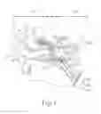 Fig. 02 - Dilation catheter with navigation sensor and vent passageway in tip