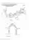 Fig. 10 - Dilation catheter with navigation sensor and vent passageway in tip