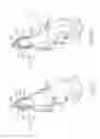 Fig. 11 - Dilation catheter with navigation sensor and vent passageway in tip