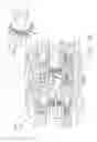 Fig. 35 - Surgical instrument systems comprising handle arrangements