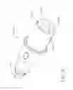 Fig. 72 - Surgical instrument systems comprising handle arrangements