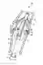 Fig. 01 - DEVICES AND METHODS FOR PERCUTANEOUS TISSUE REMOVAL
