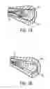 Fig. 02 - DEVICES AND METHODS FOR PERCUTANEOUS TISSUE REMOVAL