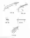 Fig. 09 - DEVICES AND METHODS FOR PERCUTANEOUS TISSUE REMOVAL