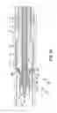 Fig. 28 - DEVICES AND METHODS FOR PERCUTANEOUS TISSUE REMOVAL