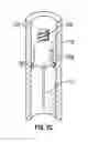 Fig. 06 - Apparatus and method for removing intra-osseous device
