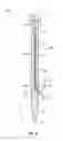 Fig. 04 - SYSTEMS AND METHODS FOR A PEDICLE SCREW ASSEMBLY