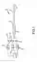 Fig. 02 - Electrophysiology catheter with modular electrode structure