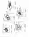 Fig. 147 - Method of hub communication with surgical instrument systems
