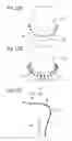 Fig. 08 - Method of estimating and restoring abutment tooth form changed by scanning and program thereof