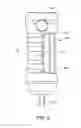 Fig. 07 - ENDODONTIC HAND FILE AND METHODS FOR ATTACHMENT