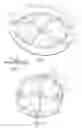 Fig. 02 - Prosthesis for repairing a hernia defect