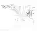 Fig. 01 - Systems and methods for protecting the cerebral vasculature