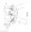 Fig. 07 - Systems and methods for protecting the cerebral vasculature