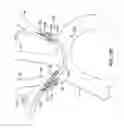 Fig. 08 - Systems and methods for protecting the cerebral vasculature