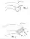 Fig. 04 - DEVICES, SYSTEMS AND METHODS FOR TREATING BENIGN PROSTATIC HYPERPLASIA AND OTHER CONDITIONS