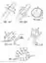Fig. 07 - DEVICES, SYSTEMS AND METHODS FOR TREATING BENIGN PROSTATIC HYPERPLASIA AND OTHER CONDITIONS