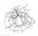 Fig. 01 - Suture guard for a prosthetic valve