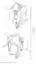 Fig. 03 - Suture guard for a prosthetic valve