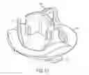 Fig. 22 - Suture guard for a prosthetic valve