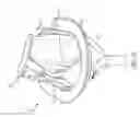 Fig. 32 - Suture guard for a prosthetic valve