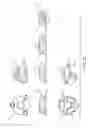 Fig. 37 - Suture guard for a prosthetic valve