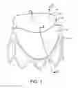 Fig. 02 - SYNTHETIC PROSTHETIC VALVE LEAFLET
