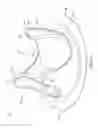 Fig. 07 - Jacket for surgical heart valve