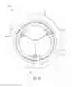 Fig. 09 - Jacket for surgical heart valve