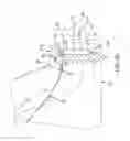 Fig. 16 - Jacket for surgical heart valve