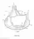 Fig. 17 - Jacket for surgical heart valve