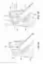 Fig. 06 - Prosthetic heart valve