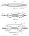 Fig. 11 - Delivery systems for prosthetic heart valve