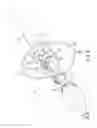 Fig. 10 - Transcatheter deployment systems and associated methods