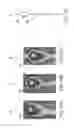 Fig. 26 - Transcatheter deployment systems and associated methods