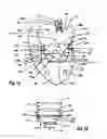 Fig. 02 - Two component mitral valve