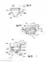Fig. 03 - Two component mitral valve