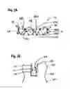 Fig. 05 - Two component mitral valve