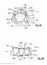 Fig. 09 - Two component mitral valve