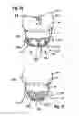 Fig. 11 - Two component mitral valve