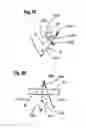 Fig. 13 - Two component mitral valve