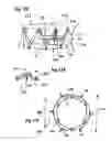 Fig. 17 - Two component mitral valve