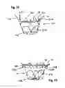 Fig. 23 - Two component mitral valve