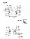 Fig. 24 - Two component mitral valve