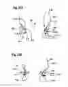 Fig. 25 - Two component mitral valve
