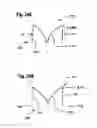 Fig. 28 - Two component mitral valve