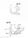 Fig. 29 - Two component mitral valve