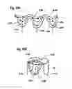 Fig. 34 - Two component mitral valve