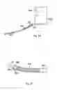 Fig. 12 - Sacroiliac fusion system