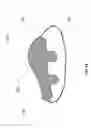Fig. 11 - Rotary arc patella articulating geometry